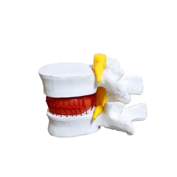Ledvenem vretencu, model medvretenčne plošče Ledvene hrbtenice pomoli skeleta hrbtenice anatomijo medicinske poučevanje